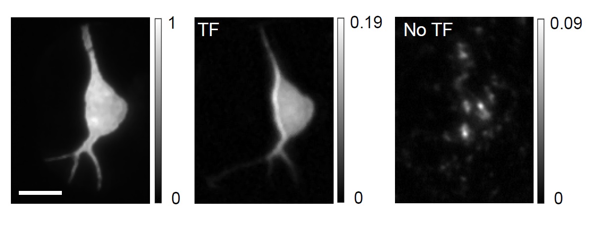 A neuron under a two-photon microscope, visualized using an unscattered laser beam (left), a temporally focused beam (middle) and a beam without temporal focusing (right)