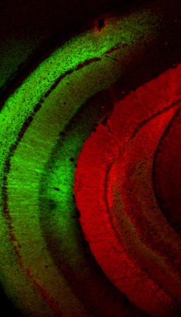 Mouse hippocampus containing two different types of channelrhodopsins. The green fluorescence marks axons entering into the hippocampal CA1 region, and the red fluorescence is expressed in the dentate gyrus part of the hippocampus (inverted V-shaped structure)