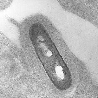 Electron micrograph of Listeria