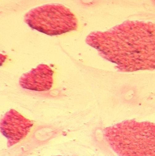 Stem cells (alkaline phosphatase staining) from the lab of Dr. Jacob Hanna