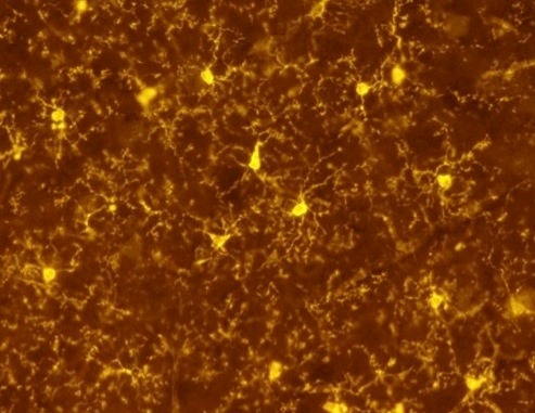 Microglia cells, obtained using a mouse model developed by Prof. Stephen Jung’s team