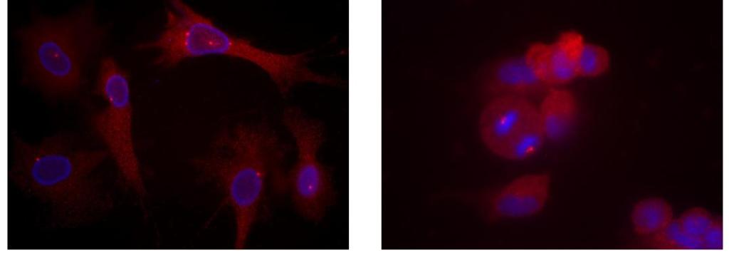 Polyploid stem cells under a fluorescent microscope, in two stages of cell division: (Left): The centrosomes (red dots) – small organelles that help the DNA ( blue) to separate into two during cell division – begin to cluster on either side of the nucleus (Right): The centrosomes are grouped into two clusters (large red dots), allowing the DNA (blue) to be divided equally between the two daughter cells. As a result, the cell divides normally, without turning malignant