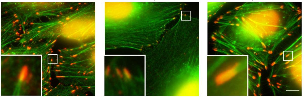 Cytoskeletal fibers (green) and adhesion sites (orange) grow when the Arp2/3 complex is present in its hybrid version (right) compared with the regular, seven-subunit version (left). When Arp2/3 is absent altogether, the fibers and the adhesion sites deteriorate (center)