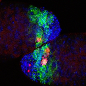 The tips of two adult fruit fly testes, viewed under a confocal microscope, are filled with dividing germ cells (green). About one quarter of these germ cells die by an alternative death pathway called germ cell death (pink and red)