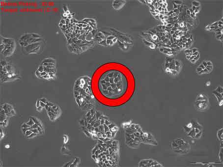 A colony of human skin cells (circled in red) is picked out by the CellCelector
