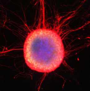 Stem cell colony with cells in the process of differentiation; from the lab of Dr. Jacob Hanna