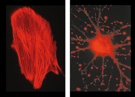 Careful actin regulation keeps the cell in shape