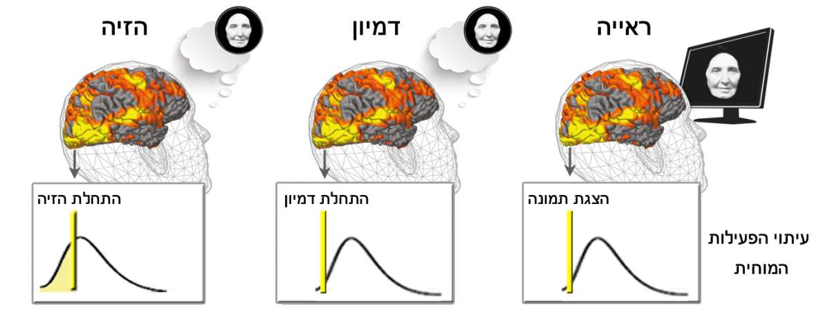 איזורי המוח הראייתיים הופעלו בשלוש הקבוצות – הקבוצה ההוזה, הרואה והמדמיינת. עם זאת, היה הבדל משמעותי בעיתוי הפעילות העצבית: בעוד באנשים הרואים ובעיוורים המדמיינים, הפעילות העצבית התרחשה בתגובה לראייה או למטלת הדמיון – באנשים עם תסמונת שארל בונה, הפעילות העצבית הקדימה את רגע ההזיה