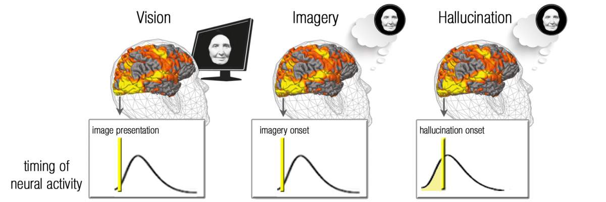 The visual centers in those seeing a film or imagining as instructed had similar timing in their brain activity, while those experiencing spontaneous hallucinations showed a gradual increase in slow fluctuations