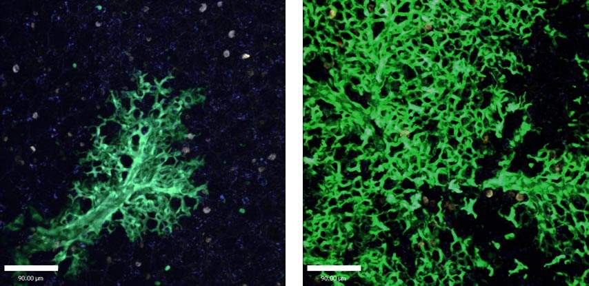 New lung cells are continuously created to replace the damaged ones: Lung tissue six weeks after stem cell transplantation (left) and 16 weeks after transplantation (right). Cells that originated in the transplanted stem cells are green, as opposed to the uncolored host lung cells. Photon-2 microscope image 