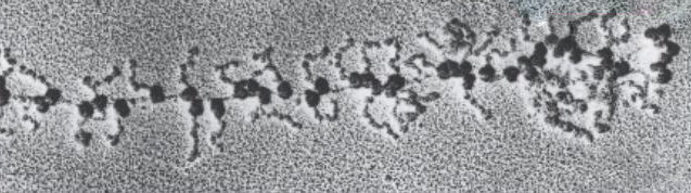 Ribosomes (large, dark circles) working their way down a strand of mRNA. Proteins are forming to the top and bottom. Amino acid scarcity results in ribosome logjams