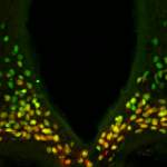 A portion of the mouse hypothalamus reveals that the protein made by the Otp gene (green) is expressed in all the neurons (red) that drive hunger – and the combined color is therefore yellow. It was known that in the developing brain, Otp is needed for the generation of these neurons. The study found that during adulthood, Otp is crucial for causing these neurons to express AgRP, a major hunger-promoting substance