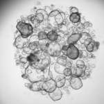 Intestinal organoids grown in the lab from stem cells derived from patients. Each sphere represents one organoid. Photo: Petro Busko, a PhD student in Biton’s lab