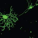 Peripheral sensory neurons in a laboratory dish