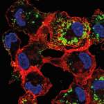 Infected macrophages