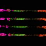 Researchers used color-coded proteins to reveal the identity of the cells in the organoids they produced. In four organoids that simulate the embryo’s central nervous system, the magenta marks proteins associated with the development of the forebrain and the midbrain, the green, the hindbrain and the red, the center of the spinal cord
