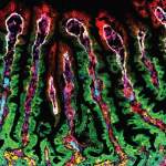 An image of tissue from the human small intestine obtained with the help of fluorescent dyes that made it possible to mark numerous proteins in parallel, thereby mapping out the various proteins produced in each part of the intestinal villi