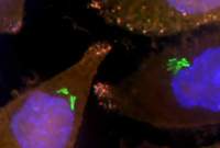 Bacteria in cancer cells 
