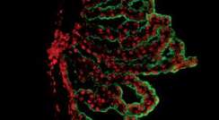Immunofluorescence microscope image of the choroid plexus. Epithelial cells are in green and chemokine proteins (CXCL10) are in red