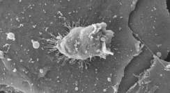 A scanning electron microscope image of a white blood cell with “legs”