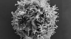 אצבעות על פני השטח של תא T. צולם באמצעות מיקרוסקופ אלקטרונים סורק