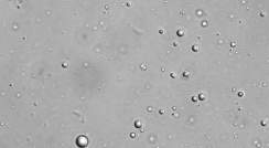 Tiny droplets formed by peptides and RNA, viewed under a microscope