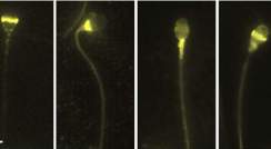  Locations of different opsins on the human sperm, viewed under a microscope, are revealed by labeling with a fluorescent antibody (bright yellow)