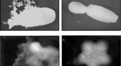 Electron microscope images of a yeast (Candida albicans) (top) and bacterial (Staphylococcus aureus) (bottom) cell, before (l) and after (r) treatment with synthetic lipopeptides, which damage their cell membranes