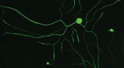 Mouse neurons lacking importin-beta1