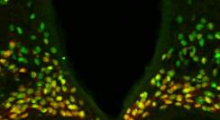 A portion of the mouse hypothalamus reveals that the protein made by the Otp gene (green) is expressed in all the neurons (red) that drive hunger – and the combined color is therefore yellow. It was known that in the developing brain, Otp is needed for the generation of these neurons. The study found that during adulthood, Otp is crucial for causing these neurons to express AgRP, a major hunger-promoting substance