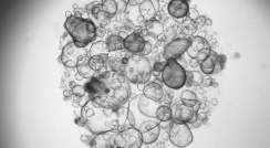 Intestinal organoids grown in the lab from stem cells derived from patients. Each sphere represents one organoid. Photo: Petro Busko, a PhD student in Biton’s lab