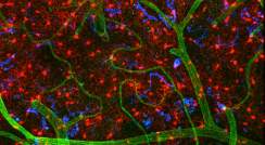 Helping the Brain’s Immune Cells Regain the Ground State