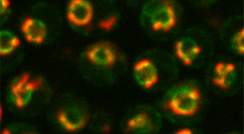 Mitochondria (red) gather around the nucleus (green) as seen under a fluorescence microscope