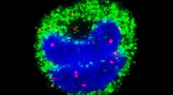 Red alert, red herrings: Malarial RNA molecules (red dots) observed inside the nuclei (blue) of monocytes (green) using fluorescence confocal microscopy