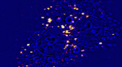 Two-photon autofluorescence image of a live cell incubated with gold nanoparticles, superimposed on a simple transmission image of the cell