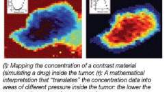(l) Mapping the concentration of a contrast material (simulating a drug) inside the tumor. (r) A mathematical interpreation that "translates" the concentration data into areas of different pressure inside the tumor. the lower the pressure, the greater the concentration.