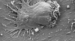 Electron microscope image of an effector cell inserting several appendages through endothelial cell membranes