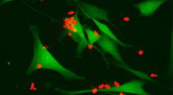 T cells attacking melanoma cells 