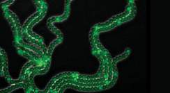 cyanobacteria reveal developmental pattern