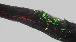 Tree roots recruit beneficial bacteria during drought. Fluorescence and bright-field imaging reveals that during drought (left) a tree root is more densely colonized by two beneficial bacteria (green and red) than after irrigation (right)