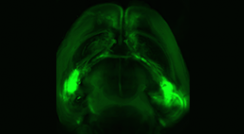 An entire mouse brain viewed from above: Neuronal extensions connect the two amygdalas 