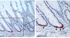 Normal human colonic crypts. SMOC-2 expression (red) in the colonic stem cells demonstrates that these cells are localized in the bottoms of the crypts. Bars represent 100 micrometers (left) and 50 micrometers (right)