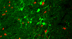 Stress-coping molecule Urocortin-3 (green) and its receptor, CRFR2 (red), 