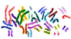 Chromosome pairs: Does doubling them help or hurt? Image: Wikimedia commons