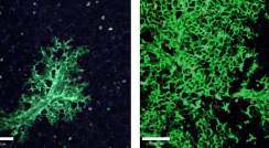 New lung cells are continuously created to replace the damaged ones: Lung tissue six weeks after stem cell transplantation (left) and 16 weeks after transplantation (right). Cells that originated in the transplanted stem cells are green, as opposed to the uncolored host lung cells. Photon-2 microscope image 