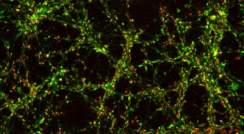 Red and green dots reveal a region in the brain that that is very dense with synapses. A special fluorescent protein allows Dr. Ofer Yizhar and his group to record the activity of the synapses