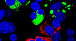 Reprogrammed cells: β cells expressing insulin (green) and the closely related δ cells expressing somatostatin (red). Blue staining shows cell nuclei. Many reprogrammed cells contain two nuclei (a unique feature of some exocrine cells) demonstrating their exocrine cell origin