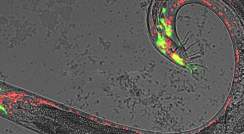 מערכת העצבים של התולעת תחת מיקרוסקופ. באדום: גרעיניהם של תאי העצב המשותפים לשני המינים, בירוק: תאי העצב הקיימים בזכרים בלבד 