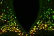A portion of the mouse hypothalamus reveals that the protein made by the Otp gene (green) is expressed in all the neurons (red) that drive hunger – and the combined color is therefore yellow. It was known that in the developing brain, Otp is needed for the generation of these neurons. The study found that during adulthood, Otp is crucial for causing these neurons to express AgRP, a major hunger-promoting substance