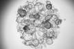 Intestinal organoids grown in the lab from stem cells derived from patients. Each sphere represents one organoid. Photo: Petro Busko, a PhD student in Biton’s lab